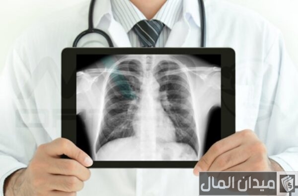 راتب أخصائي أشعة في السعودية