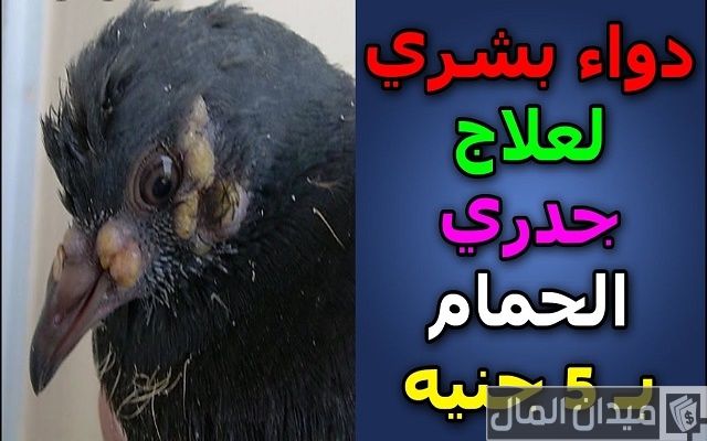 علاج جدري الحمام في المنزل