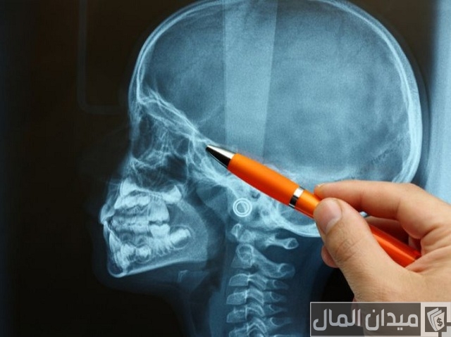 هل تخصص الأشعة مطلوب